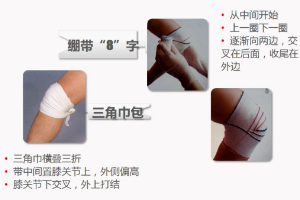 紅十字應急救護技能系列講座——包扎——關于包扎方法
