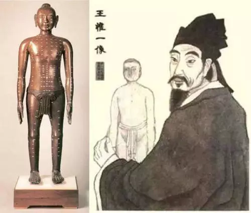 王惟一發明并鑄造<em>針灸</em>銅人