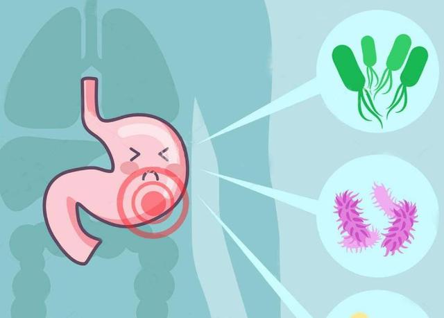 幽門螺桿菌、胃炎和胃潰瘍的諾貝爾獎之路