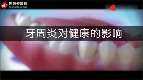 牙周炎病變過程及刮治，<em>3D</em><em>動畫</em><em>演示</em>
